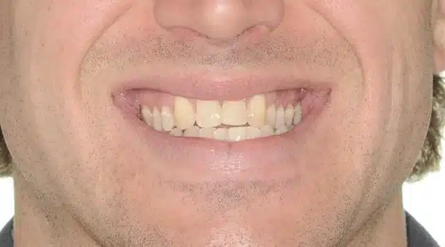 NYC BEST ORTHODONTIST 6.jpg