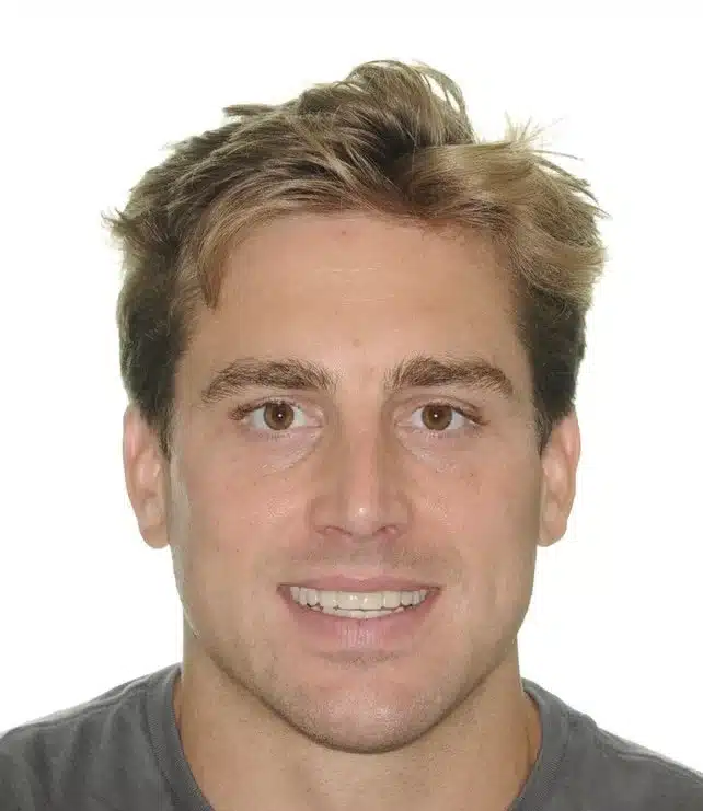 NYC Best Orthodontist 7.jpg