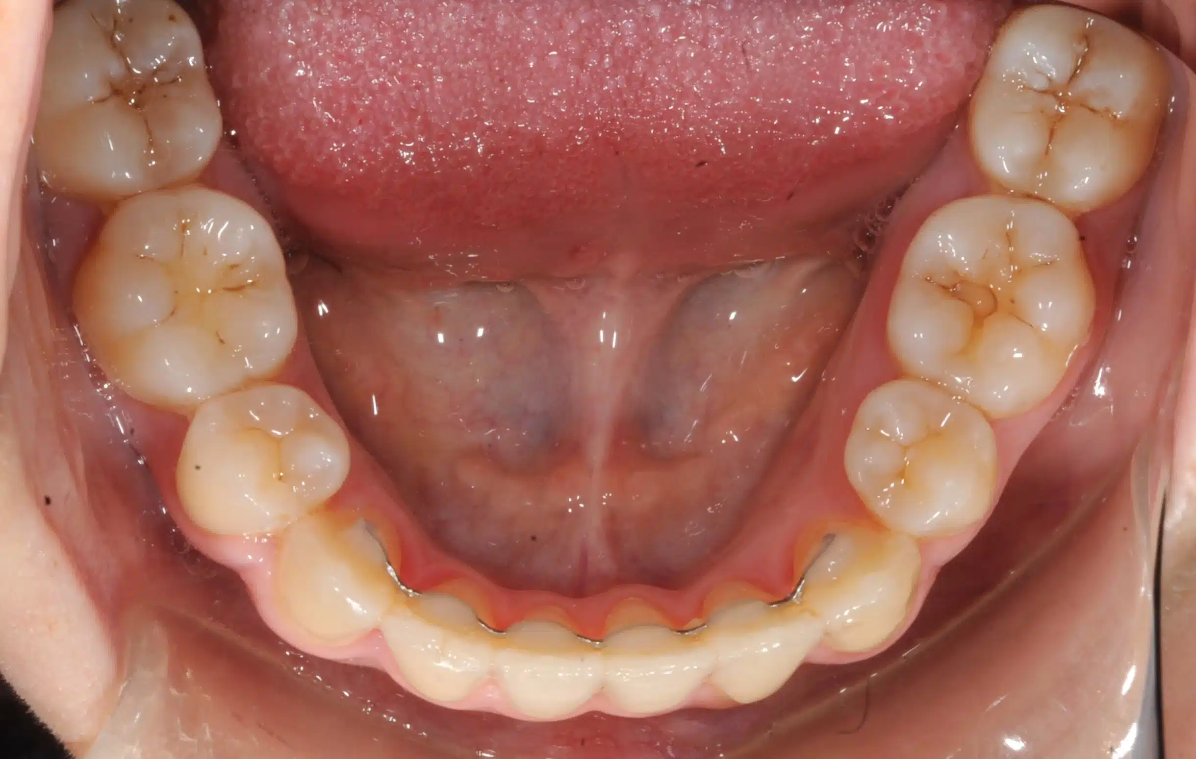 NYC Best Orthodontist 9.jpeg