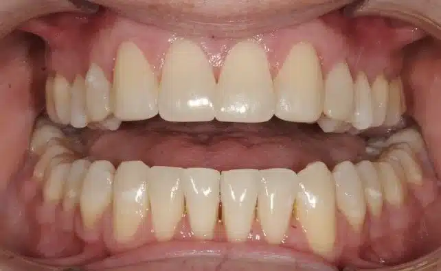 NYC Best Orthosontist 13.jpg