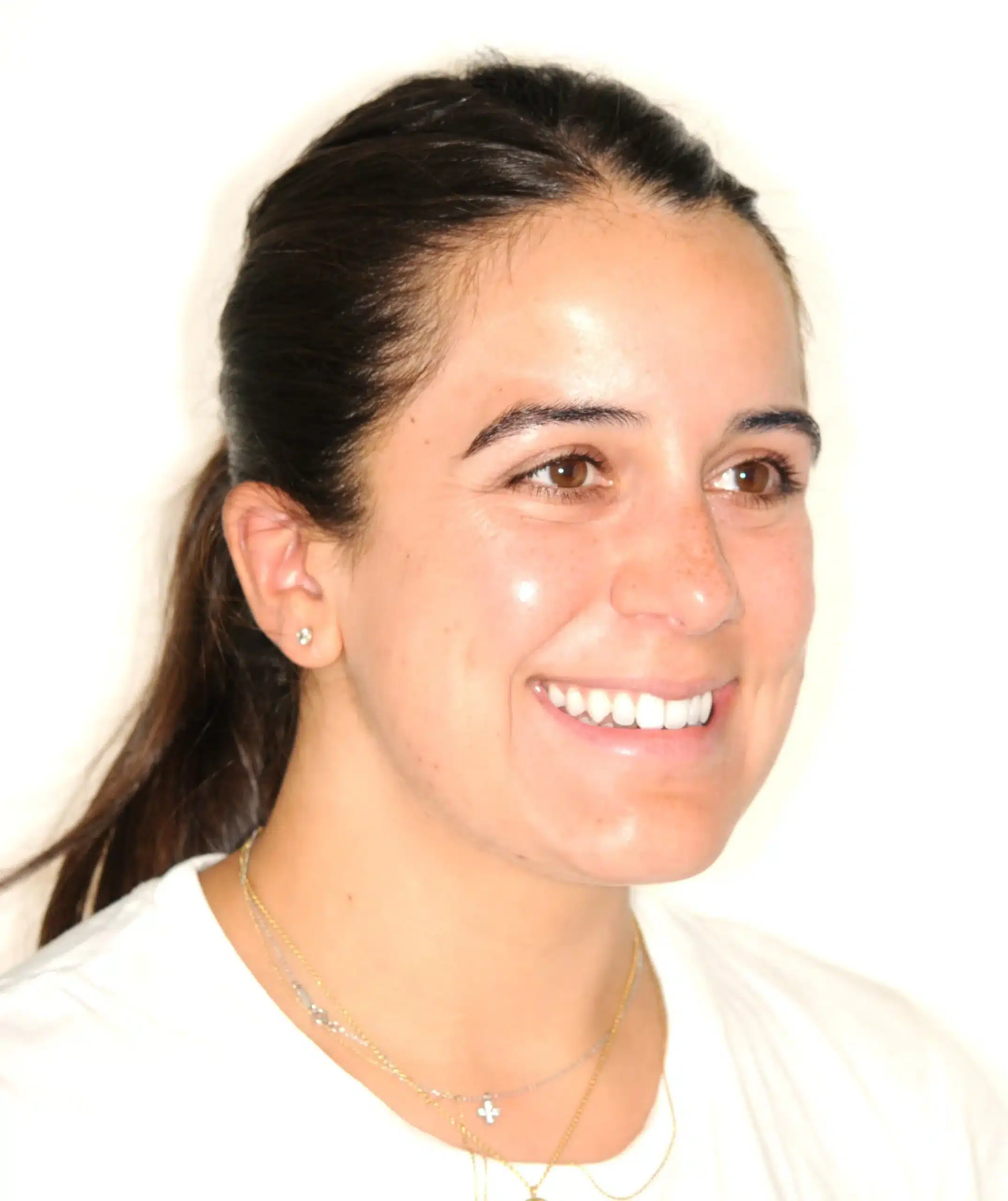 retention four years later relapse 5-25-2021 - 130950 - Ines Castro - Retention 40 - Facial 34 R.jpg