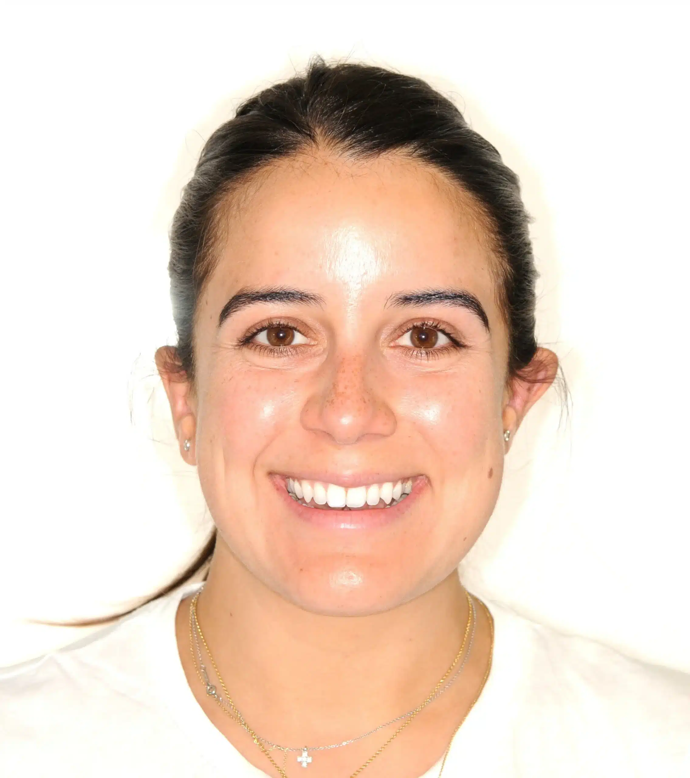 retention four years later relapse 5-25-2021 - 130950 - Ines Castro - Retention 40 - Facial Front Smiling.jpg