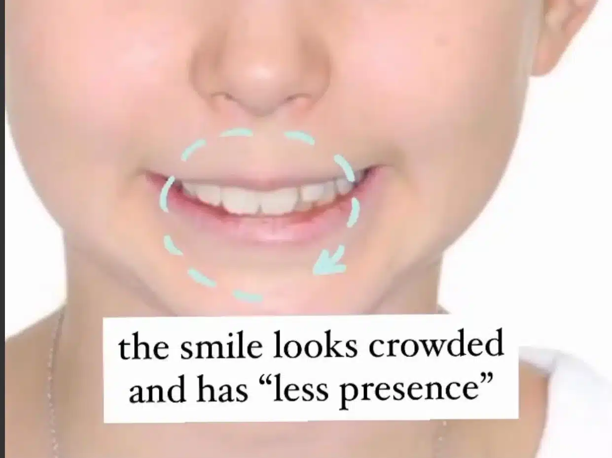 smile5.jpg