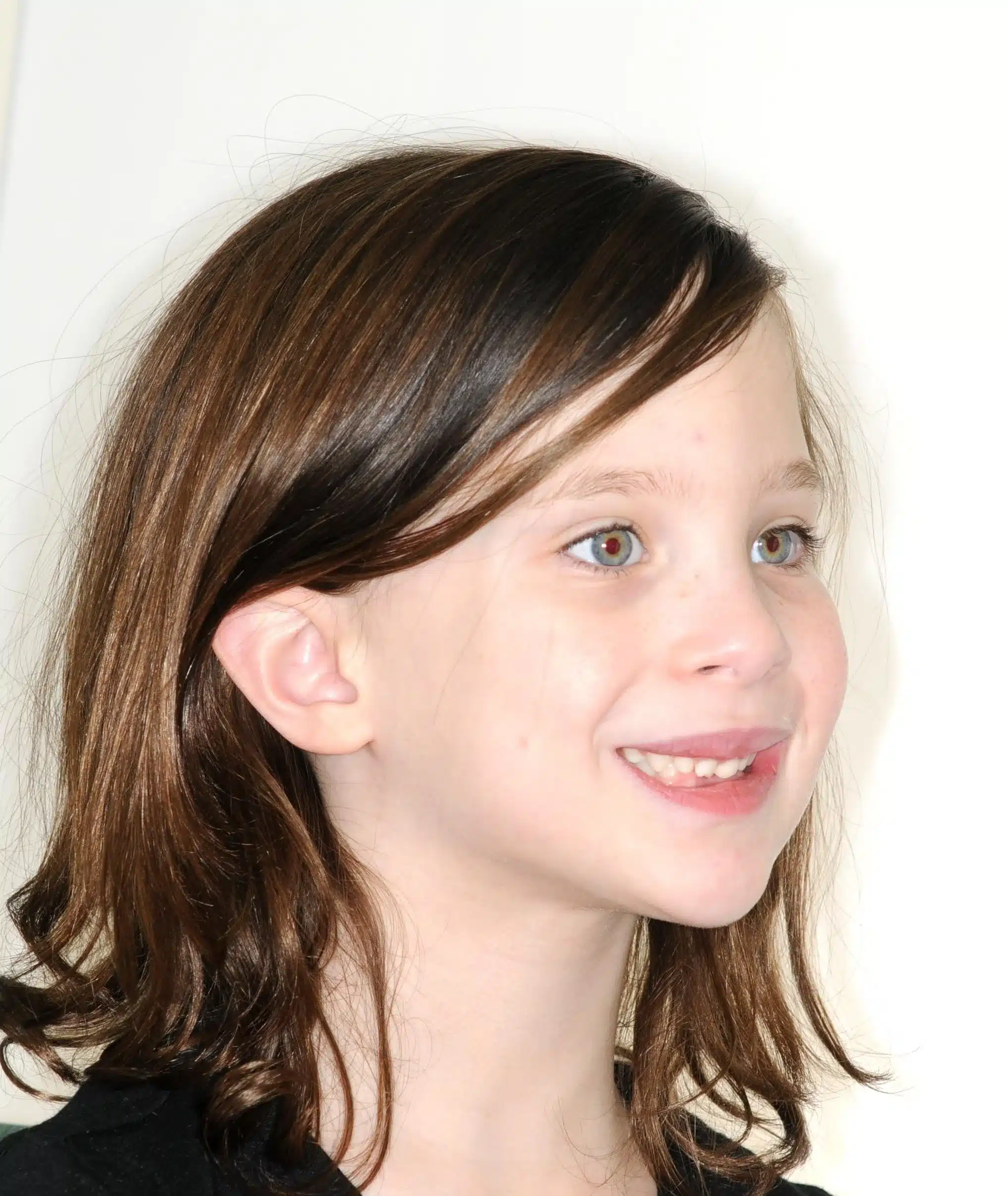 Why Early Orthodontics Treatment is essential (1).jpg