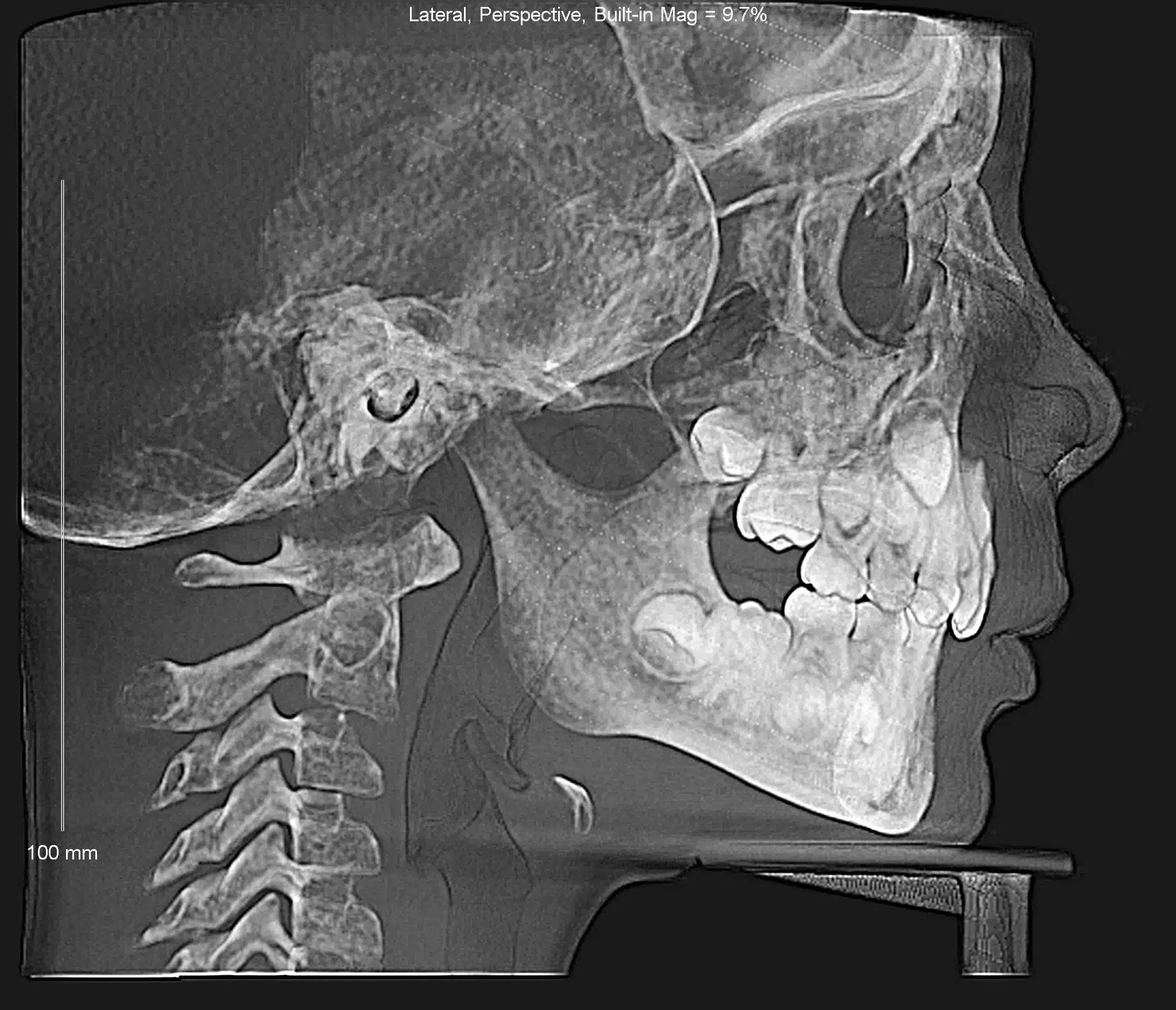 Why Early Orthodontics Treatment is essential (15).jpg