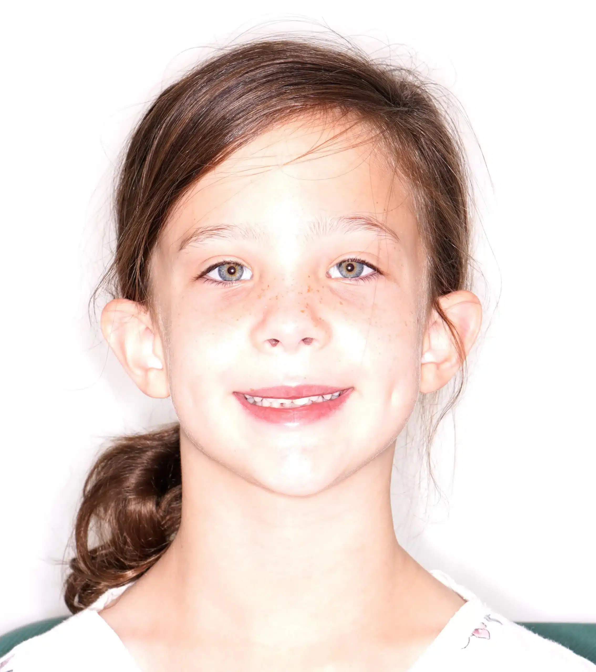 Why Early Orthodontics Treatment is essential (2).jpg