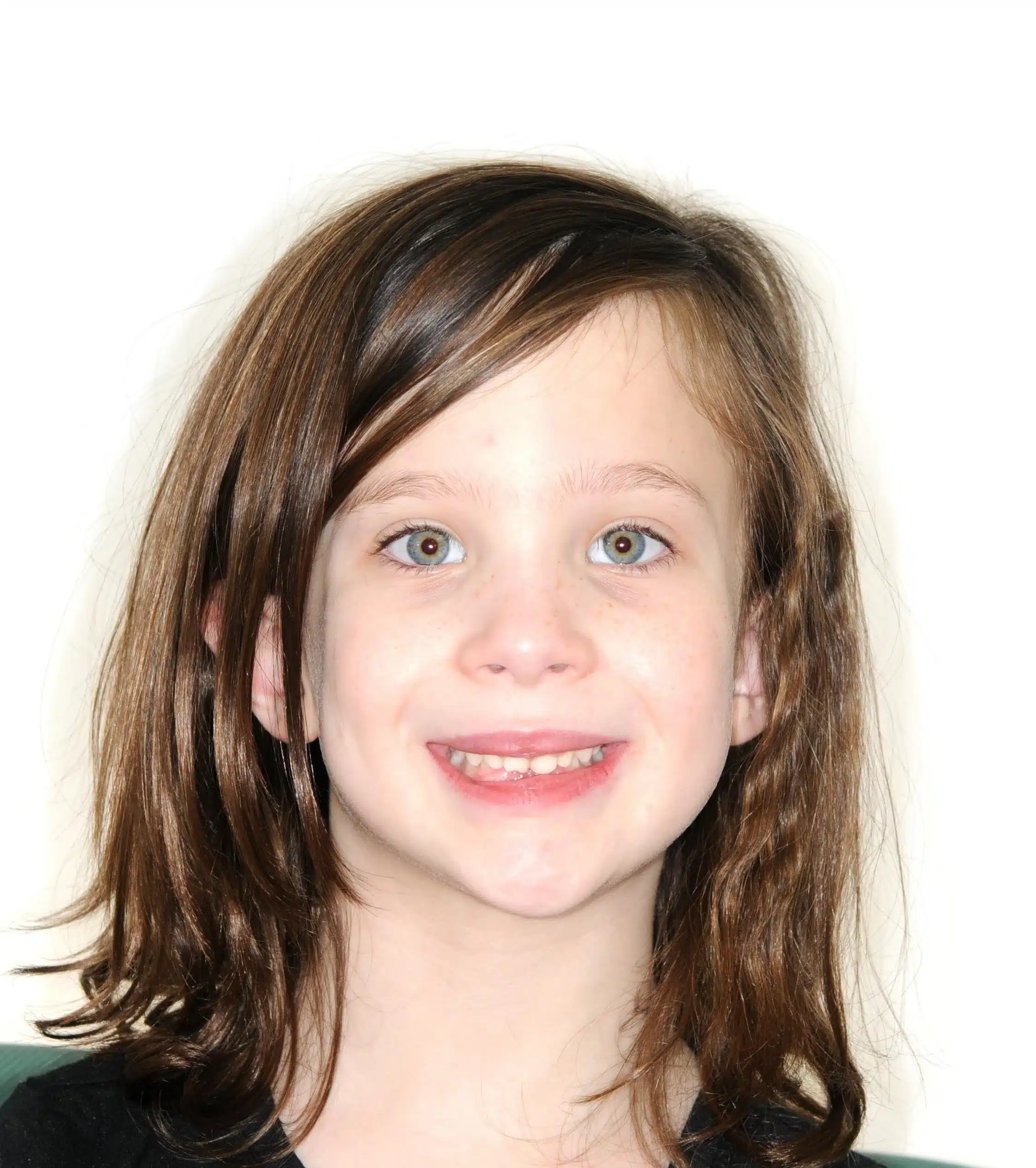 Why Early Orthodontics Treatment is essential (2) .jpg
