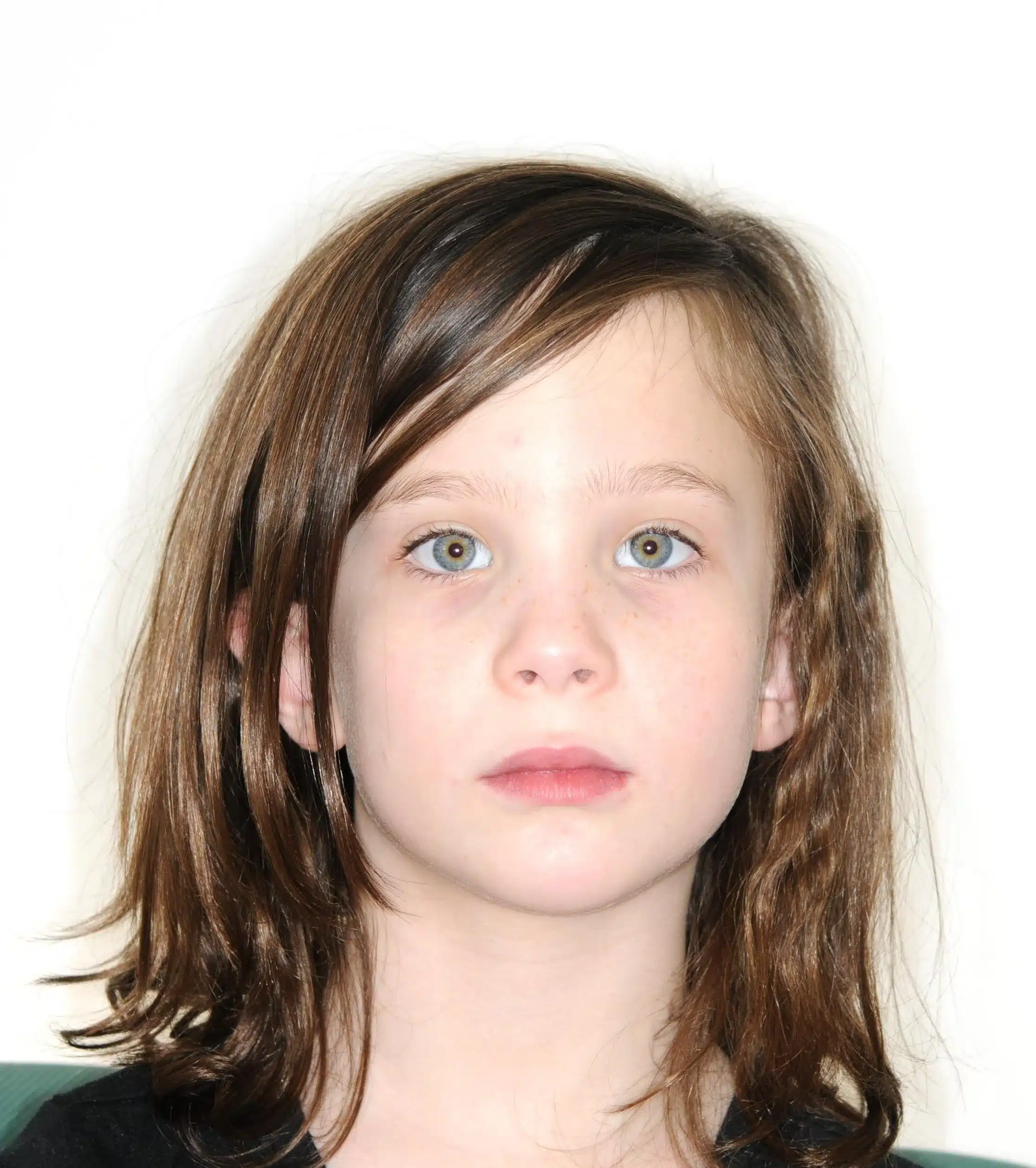 Why Early Orthodontics Treatment is essential (3).jpg