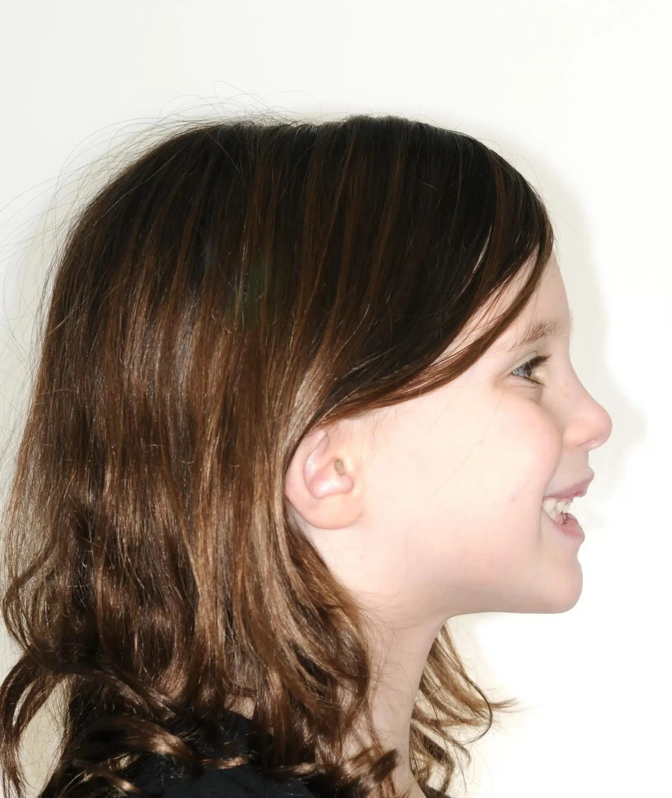 Why Early Orthodontics Treatment is essential (4).jpg
