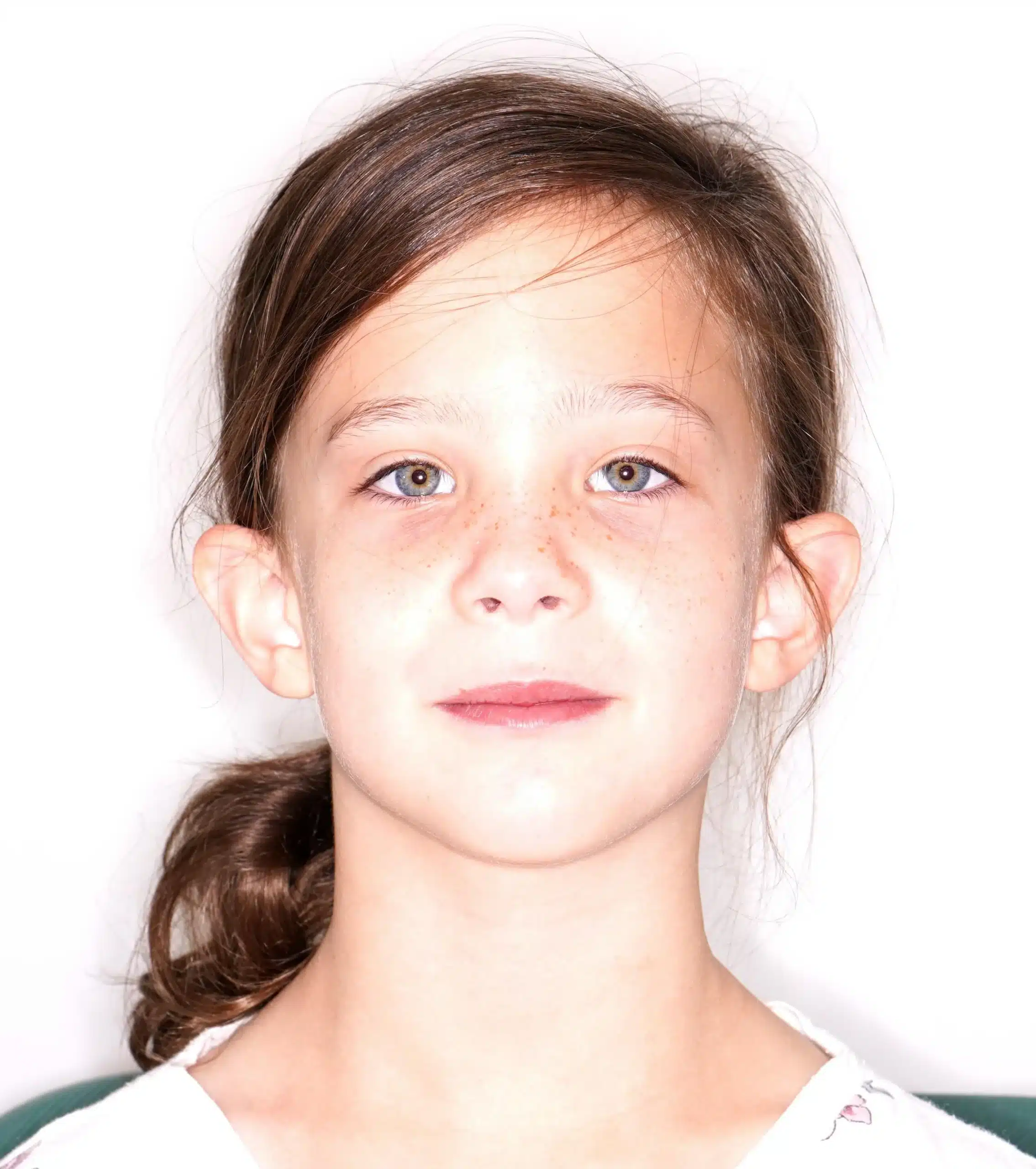 Why Early Orthodontics Treatment is essential (4).jpg
