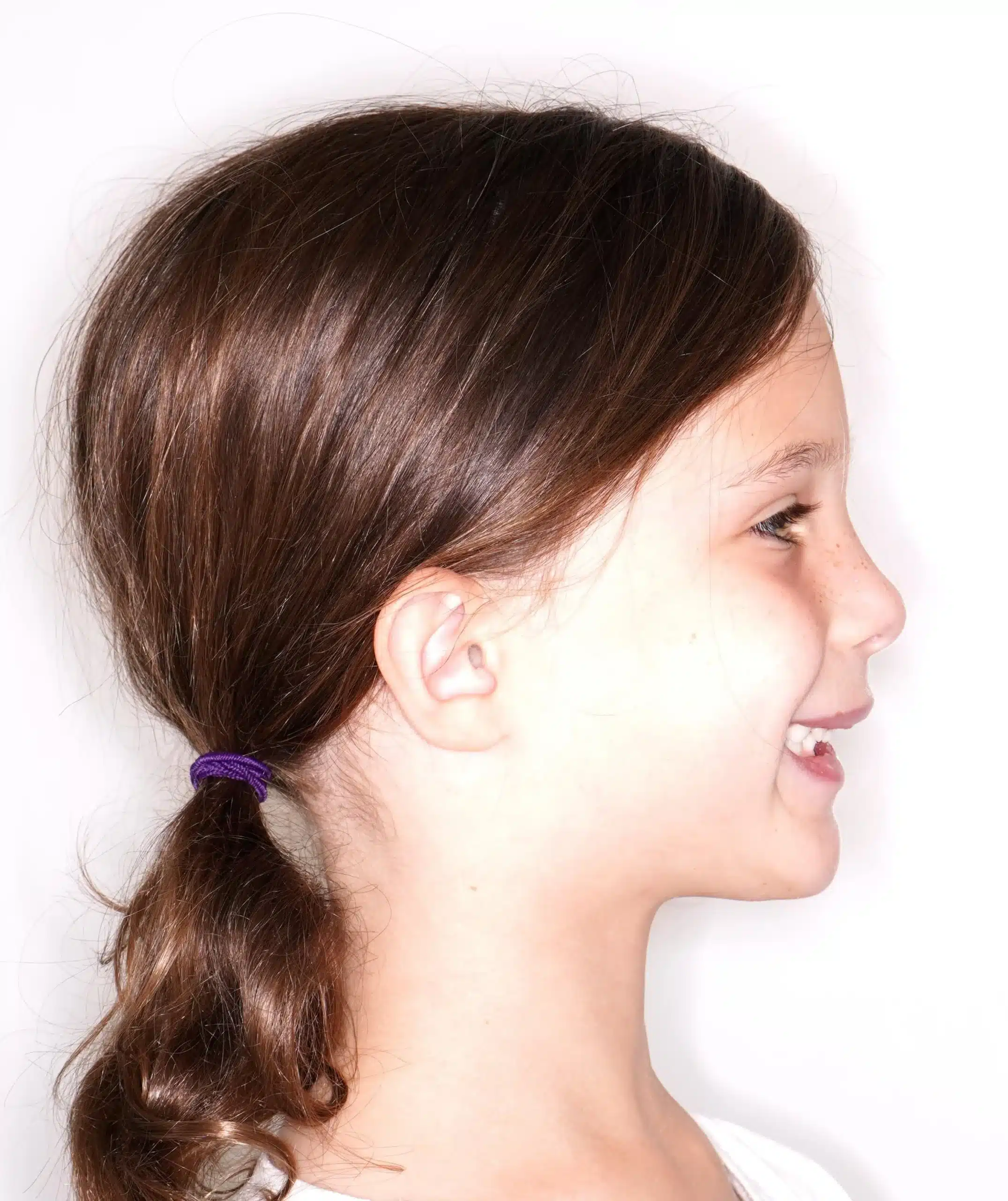 Why Early Orthodontics Treatment is essential (5).jpg