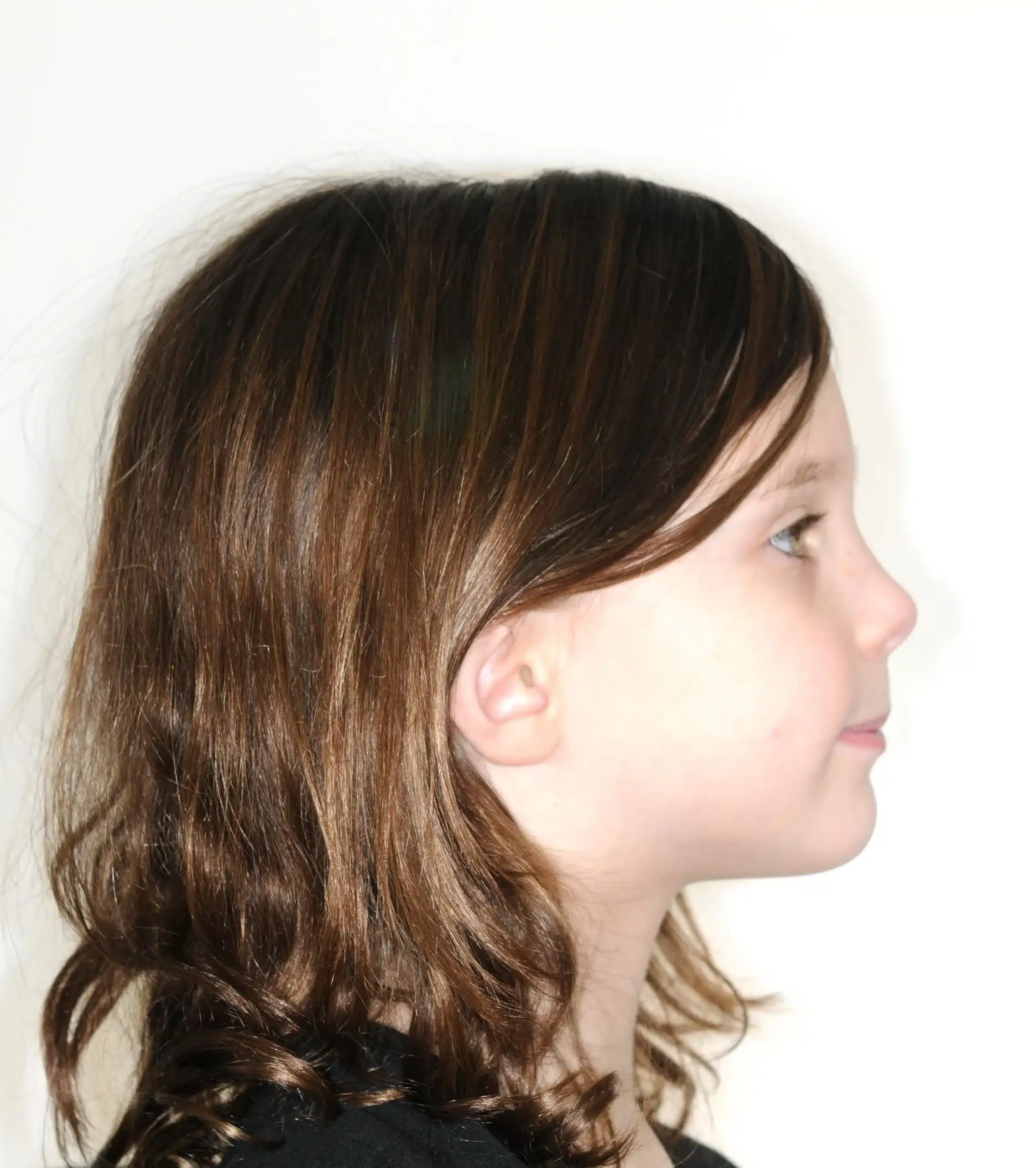 Why Early Orthodontics Treatment is essential (5).jpg