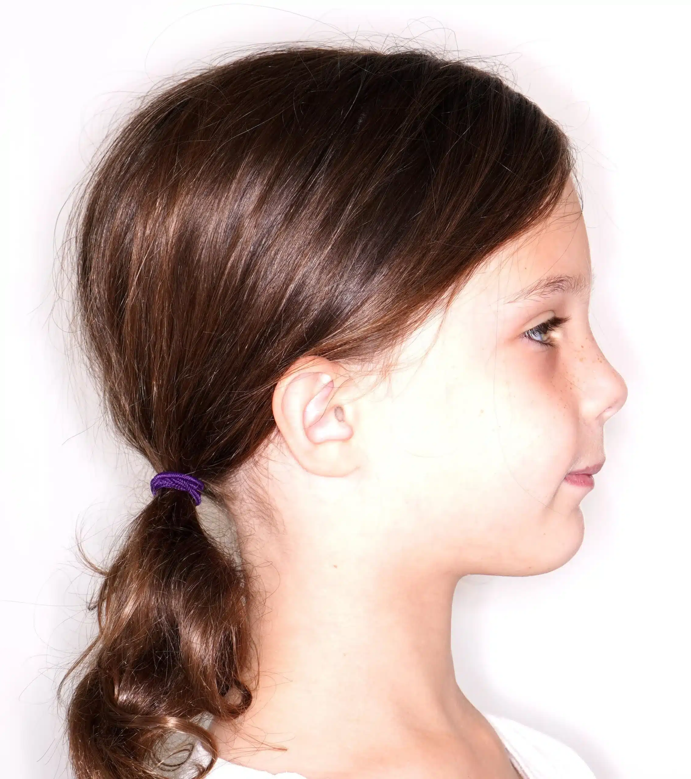 Why Early Orthodontics Treatment is essential (6).jpg